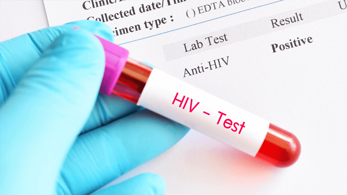 HIV-test-before-marriage