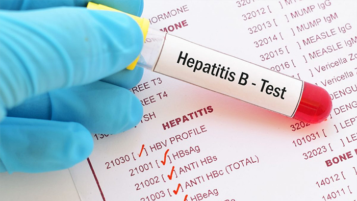 hepatitis-test-before-marriage